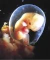embryo.jpg