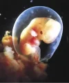 embryo.webp