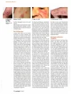 Morgellons003.webp
