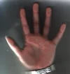 linke Hand.webp