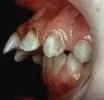 mallo.webp