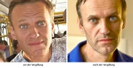 Nawalny_vor-und-nach-der Vergiftung.webp