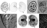 Colpoda-cucullus-from-live-A-DG-protargolimpregnated-B-C-H-I-and-silver.webp
