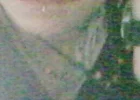 Wieder Hals.webp