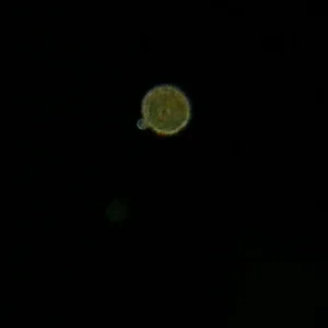 14.5.20 , 23 Uhr Orb,Männerkopf in der kleinen Blase!?!