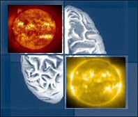 SunBrain