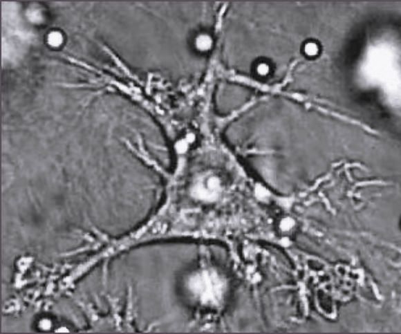 Dendritic_cell.JPG