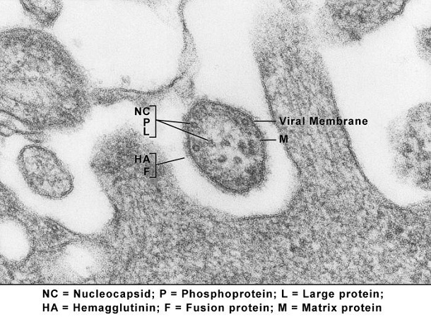 Measles.jpg