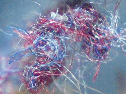 Morgellons_Fibers.jpg