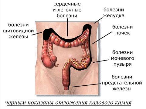 large_intestine.gif